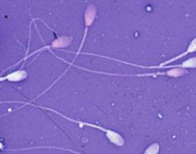 ���������������: �� ����������� �������� фото