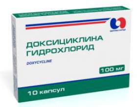 ���������: �������� � ������� �������� фото
