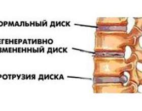 ������� �������� ���������� ������糿 ����� фото